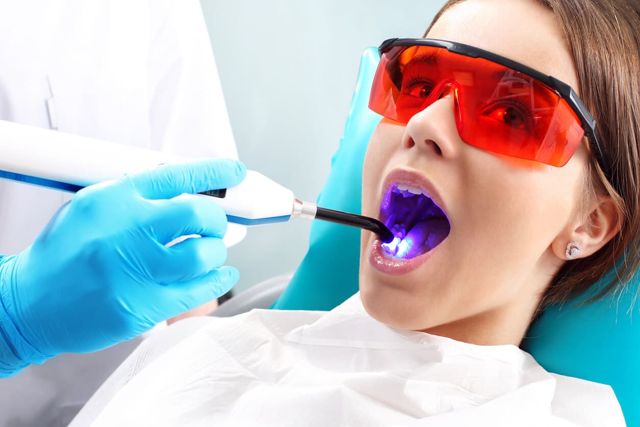 Dental Cleaning
